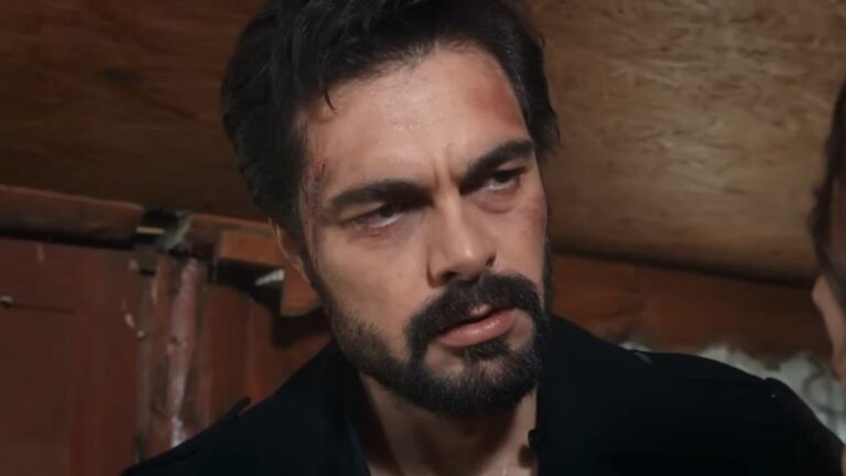 Yaman z pokiereszowana twarzą po wypadku.