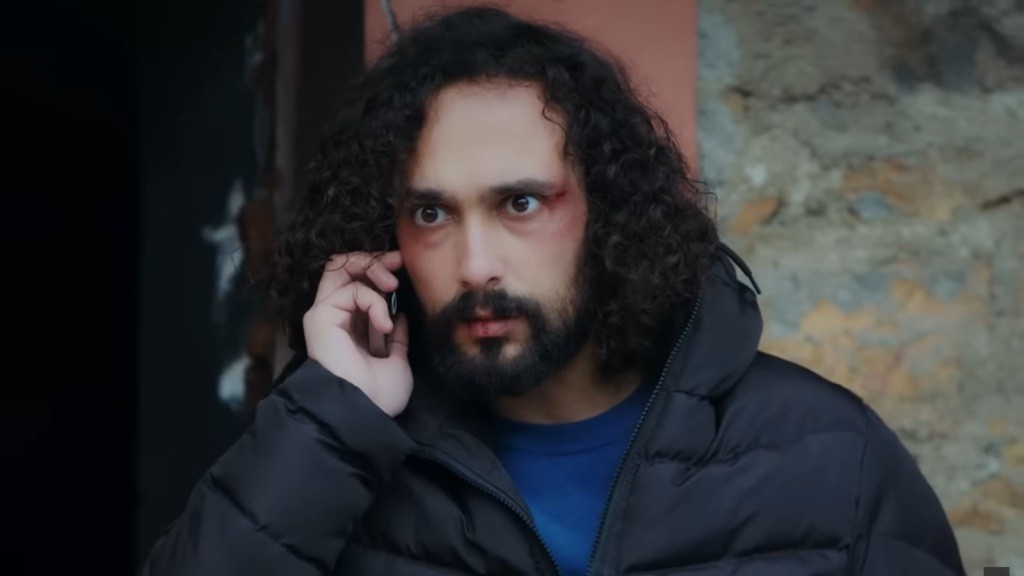 Semih rozmawia przez telefon. Ma rozciętą brew i podkrążone oczy.