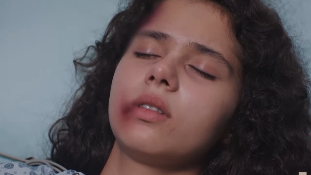 Zbliżenie na twarz nieprzytomnej Melodi, leżącej na szpitalnym łóżku.