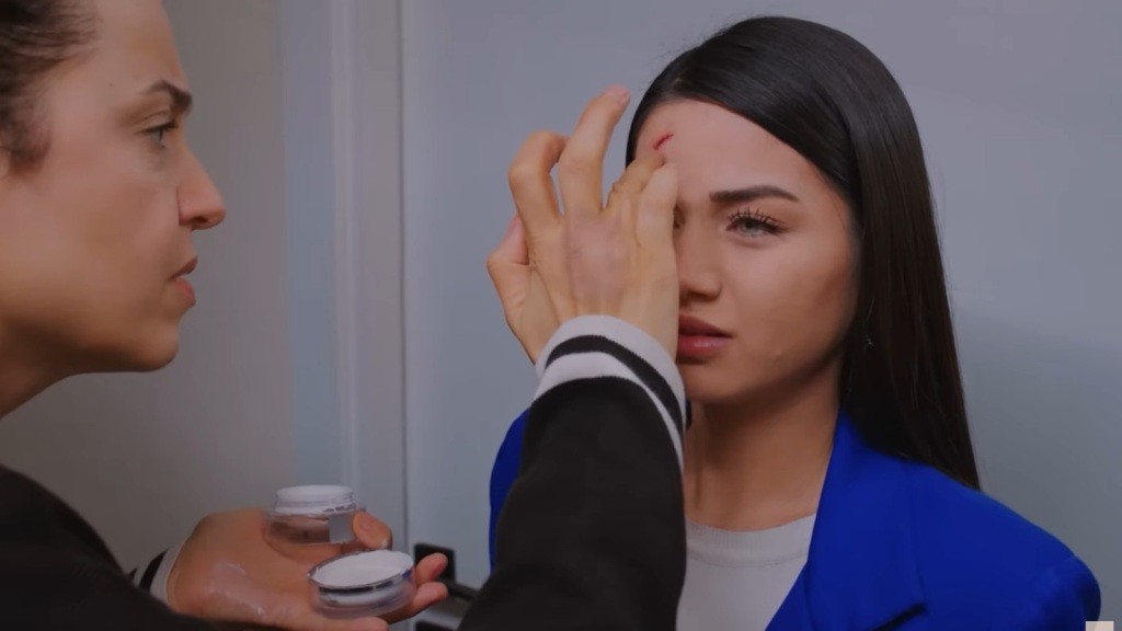 Cavidan nakłada maść na rozcięcie na czole Bahar.