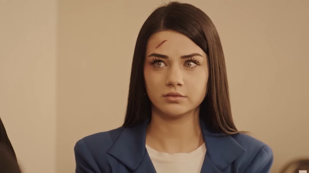 Bahar ma rozcięcie na czole. Spogląda niepewnie.