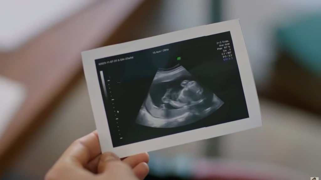 Zbliżenie na zdjęcie USG płodu.